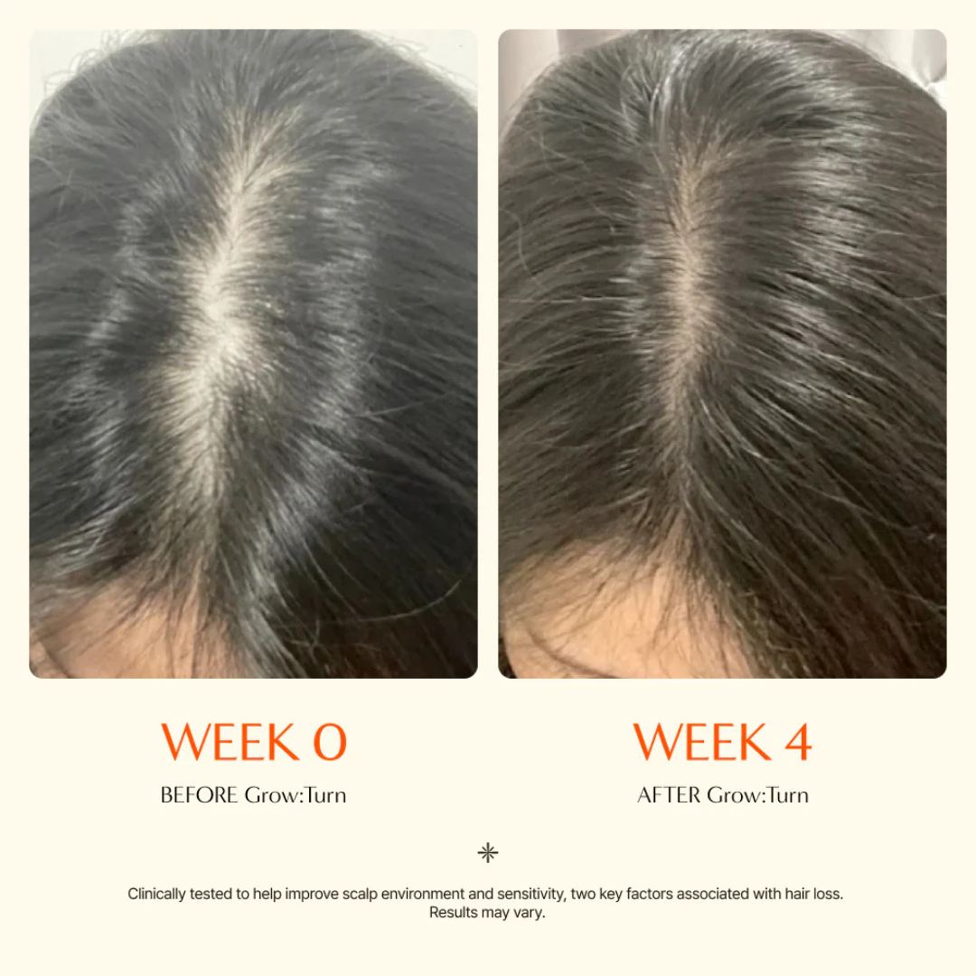 Growturn Hair Growth Serum with Built-in Brush
