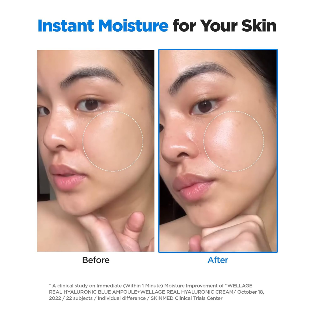 Real Hyaluronic Blue 100 Ampoule