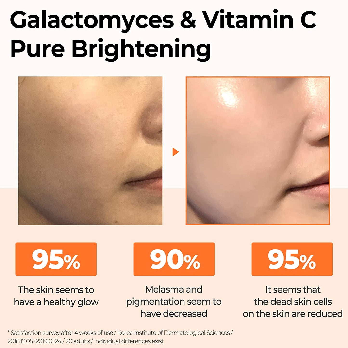 Galactomyces Pure Vitamin C Glow Toner