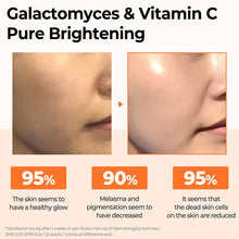Load image into Gallery viewer, Galactomyces Pure Vitamin C Serum
