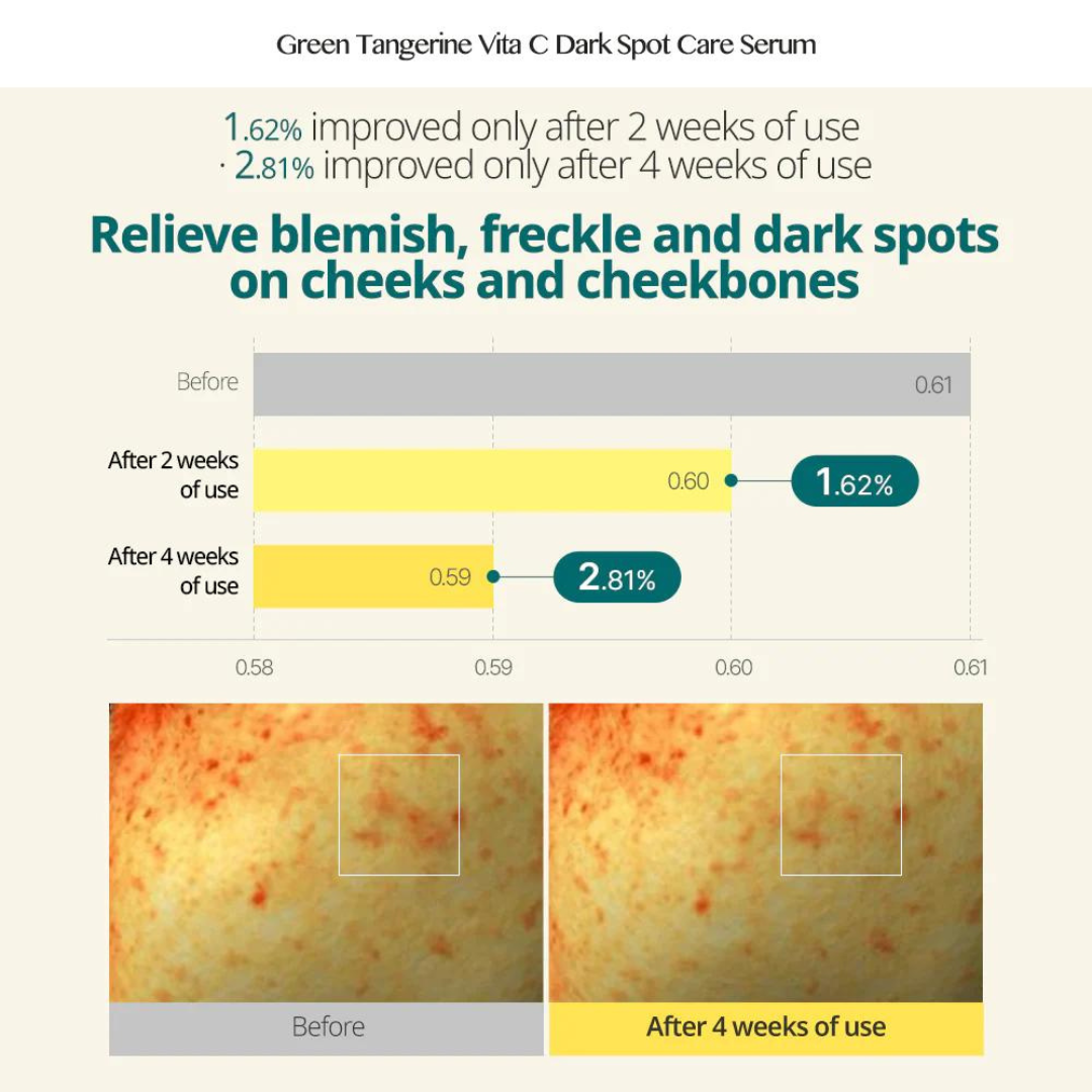 Green Tangerine Vita C Dark Spot Care Serum