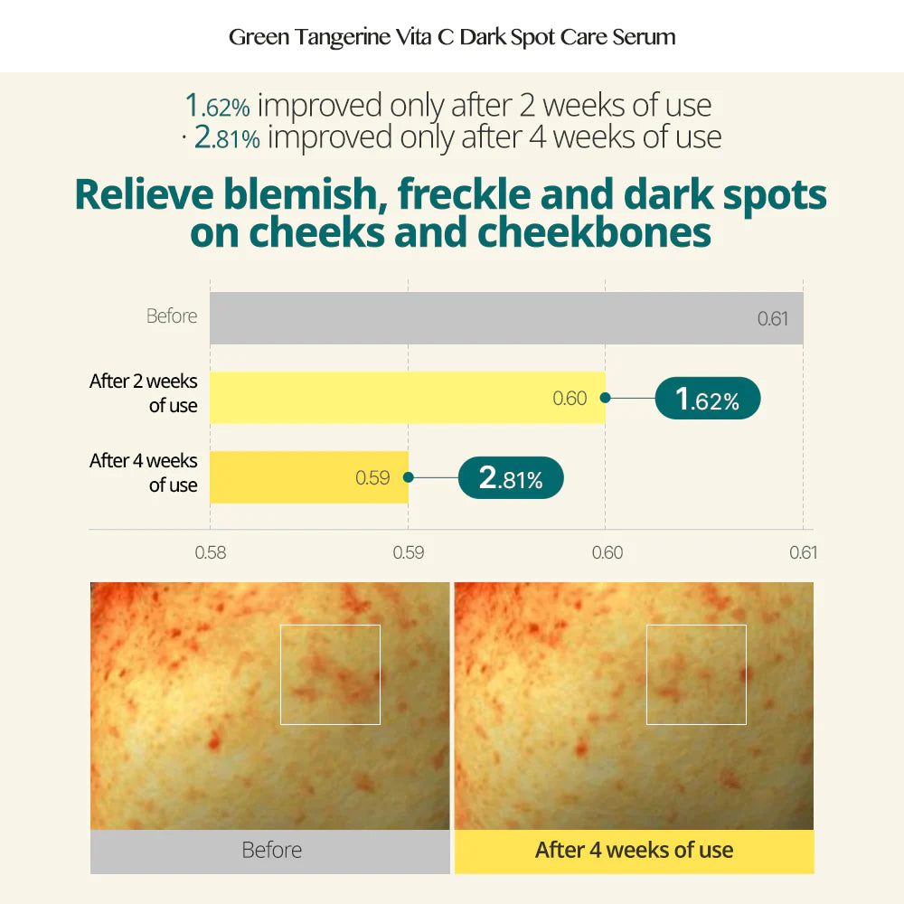 Green Tangerine Vita C Dark Spot Serum + Cream